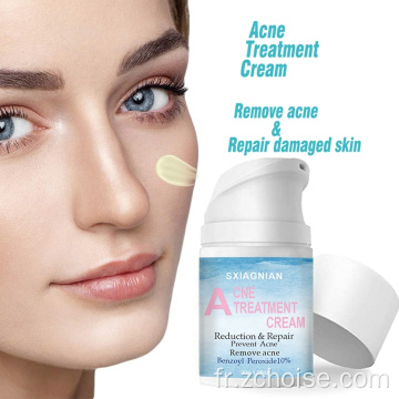 meilleure crème anti-acné pour le visage